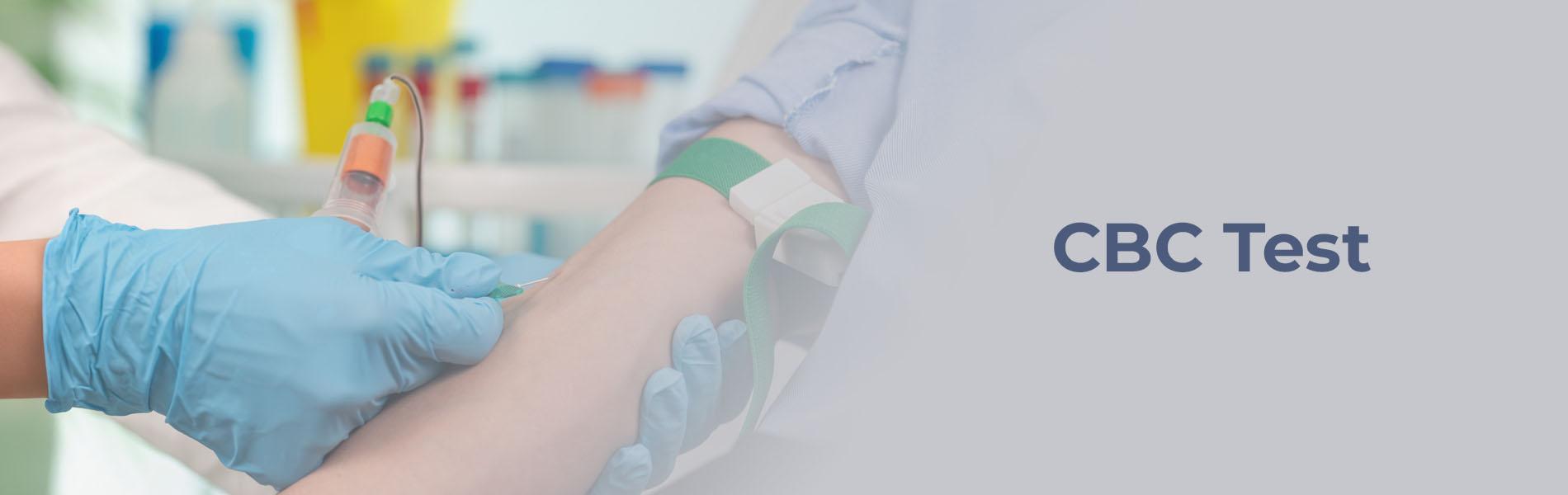Feeling Weak All the Time? A CBC Test Can Reveal More Than You Think