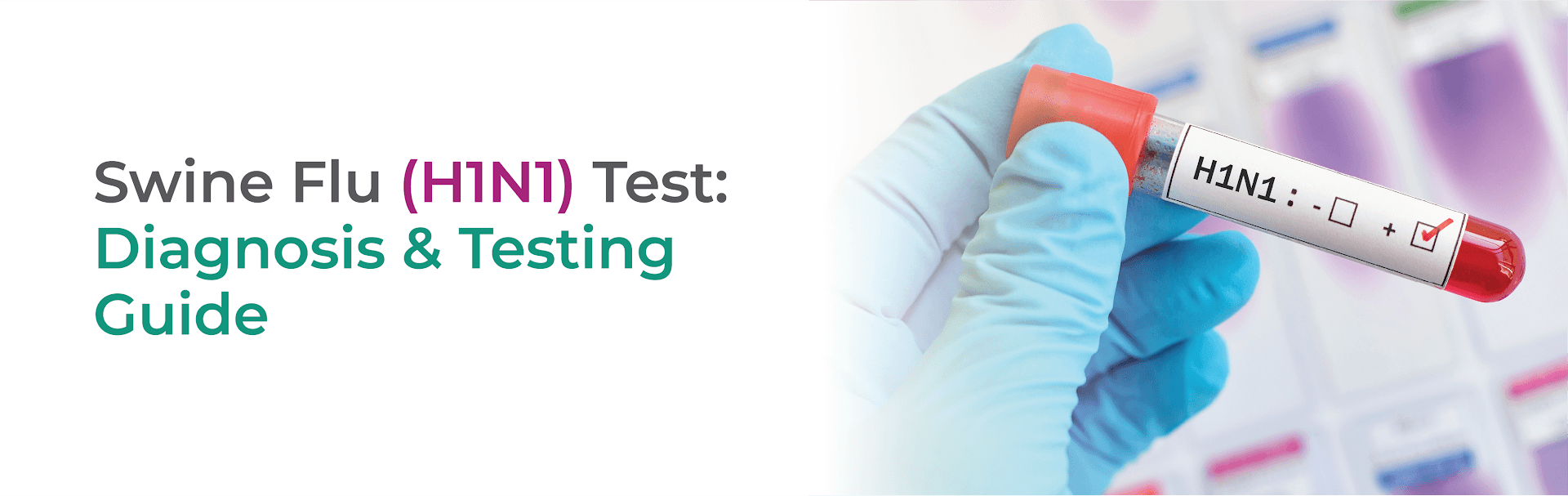 Swine Flu (H1N1) Test: Diagnosis & Testing Guide